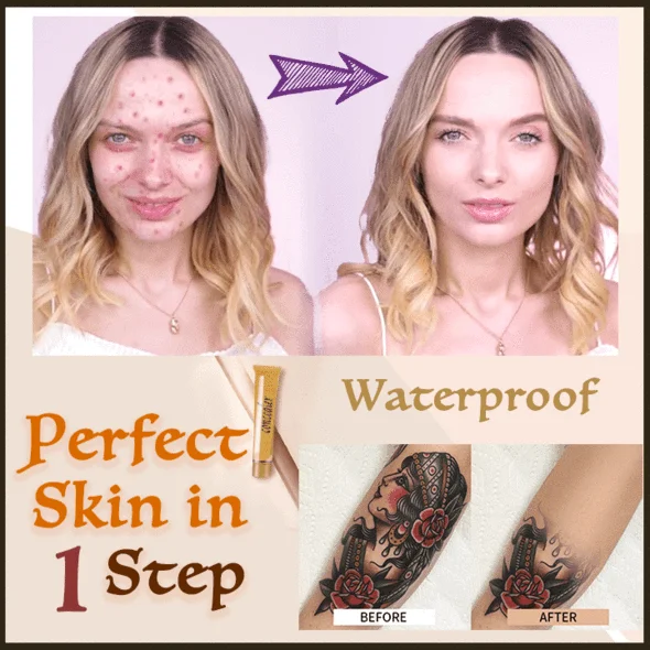 ElectroMatic matu vītņu epilators