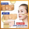 Instant Dark Spot Lifting Ampula