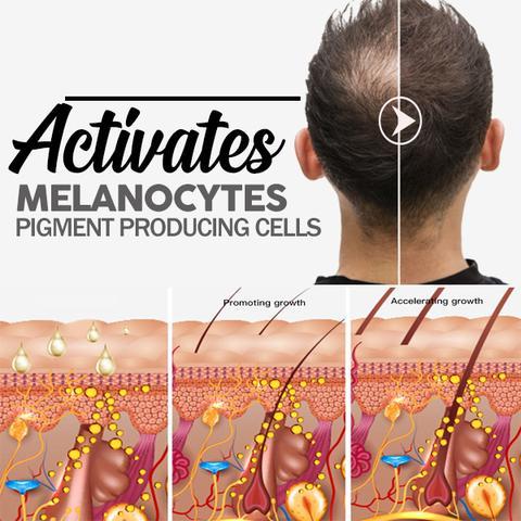 Matu augšanas šampūnu bārs - Image 3