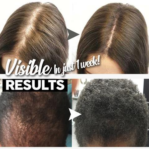 Matu augšanas šampūnu bārs - Image 4