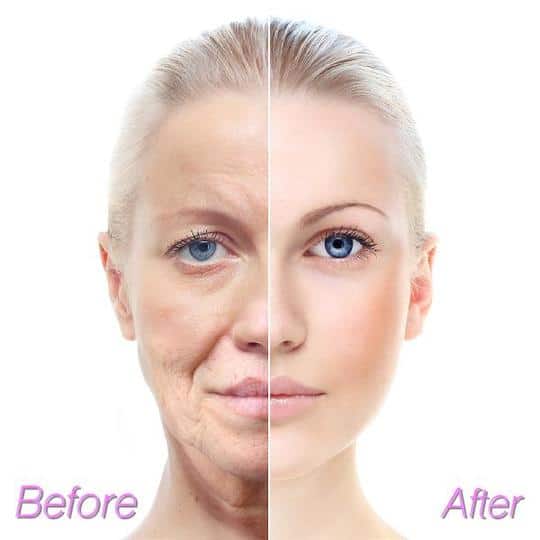 Ampulu serums - Image 4