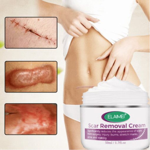 Skin Rebound Scarless krēms - Image 4