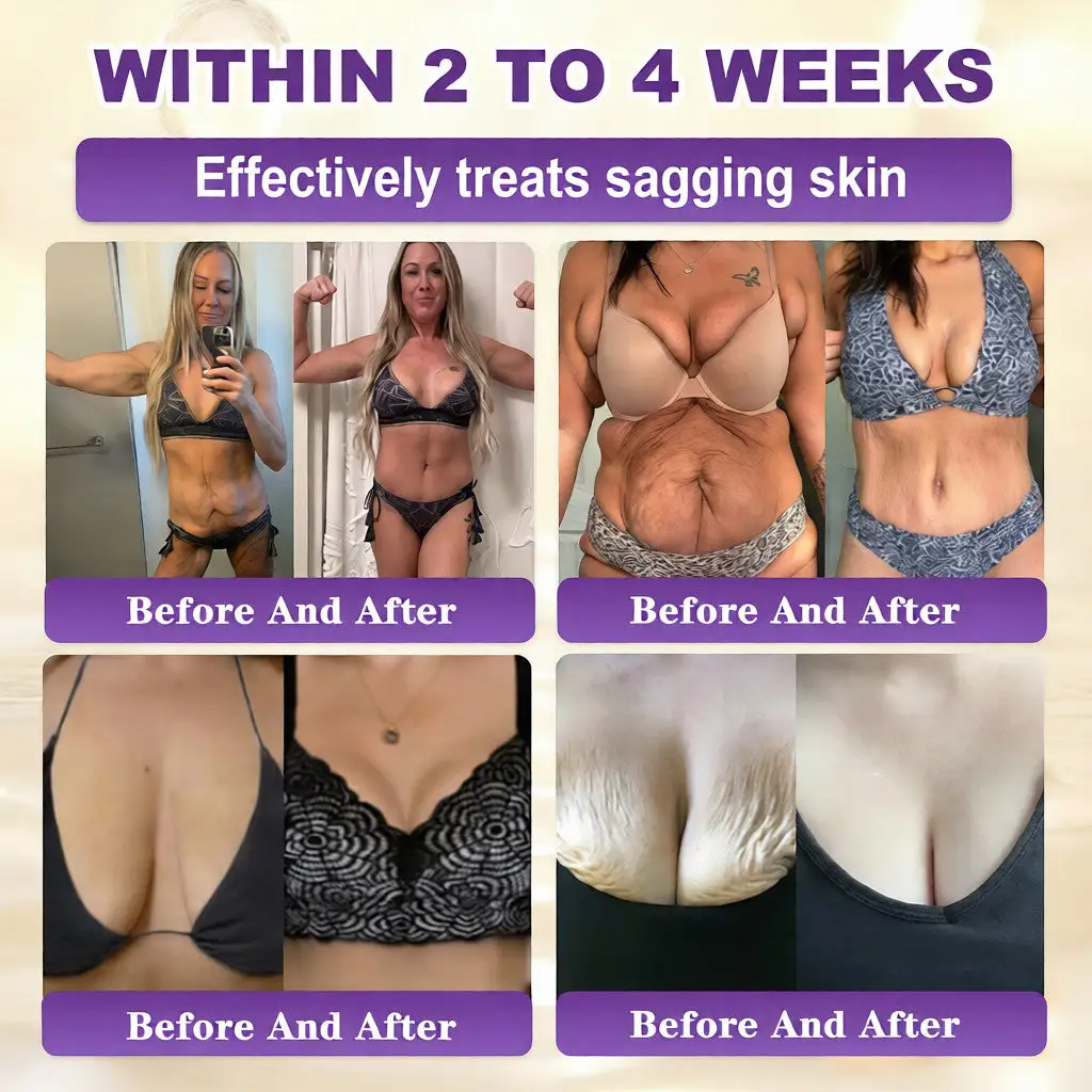 Biotīna 10-in-1 ādas atjaunošanas krēms - Image 3