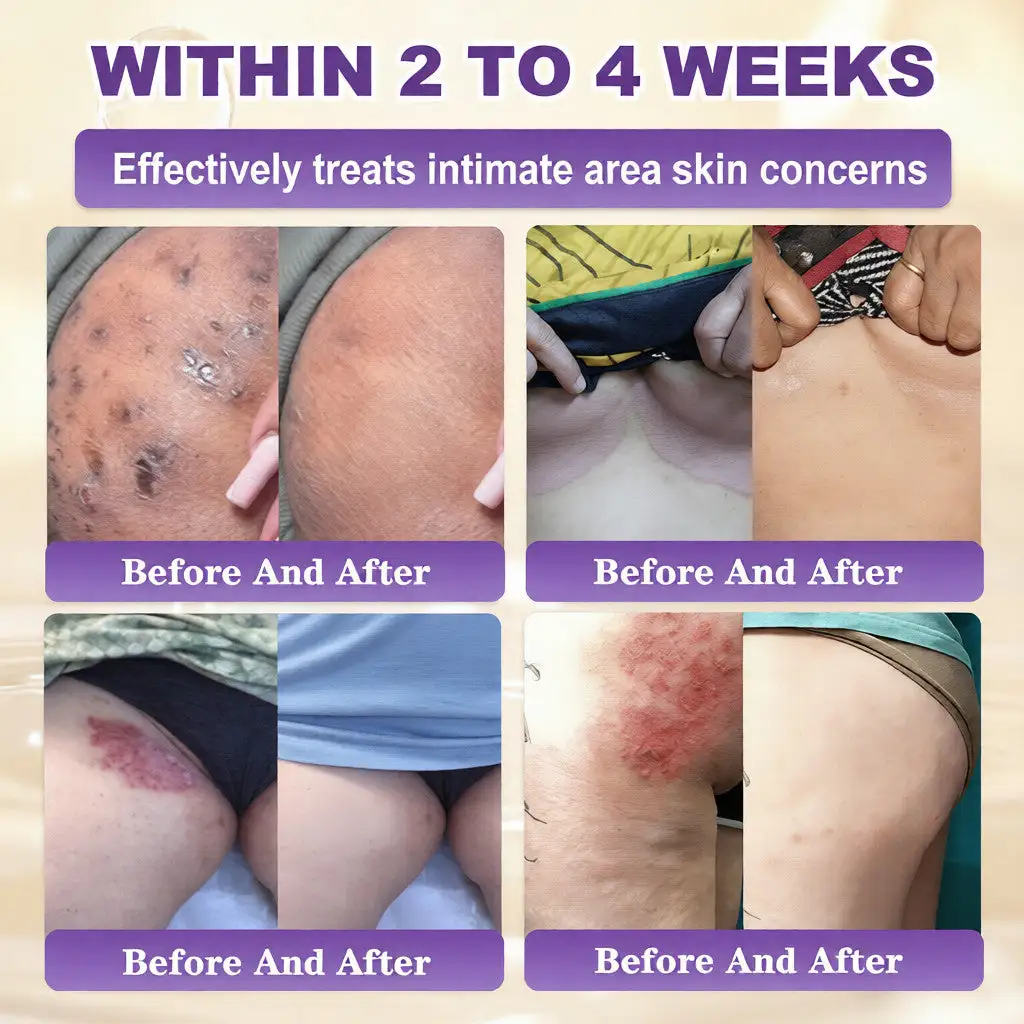 Biotīna 10-in-1 ādas atjaunošanas krēms - Image 4