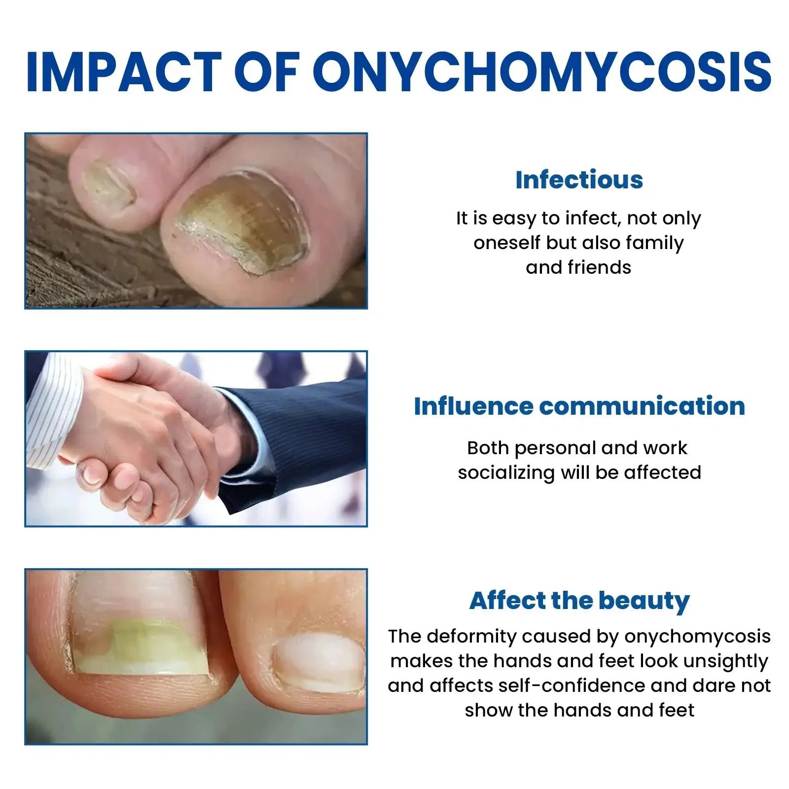 Sēnīšu nagu labošanas plāksteri - Image 2