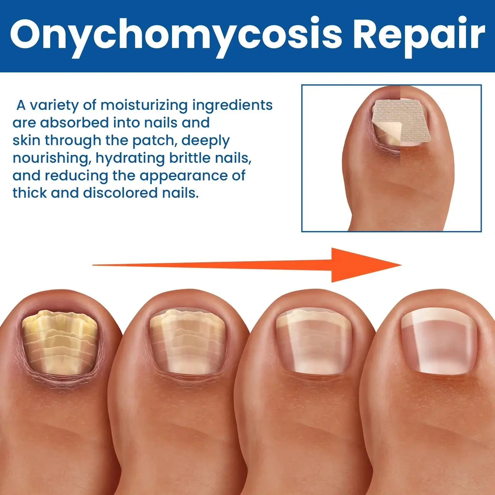 Sēnīšu nagu labošanas plāksteri - Image 4