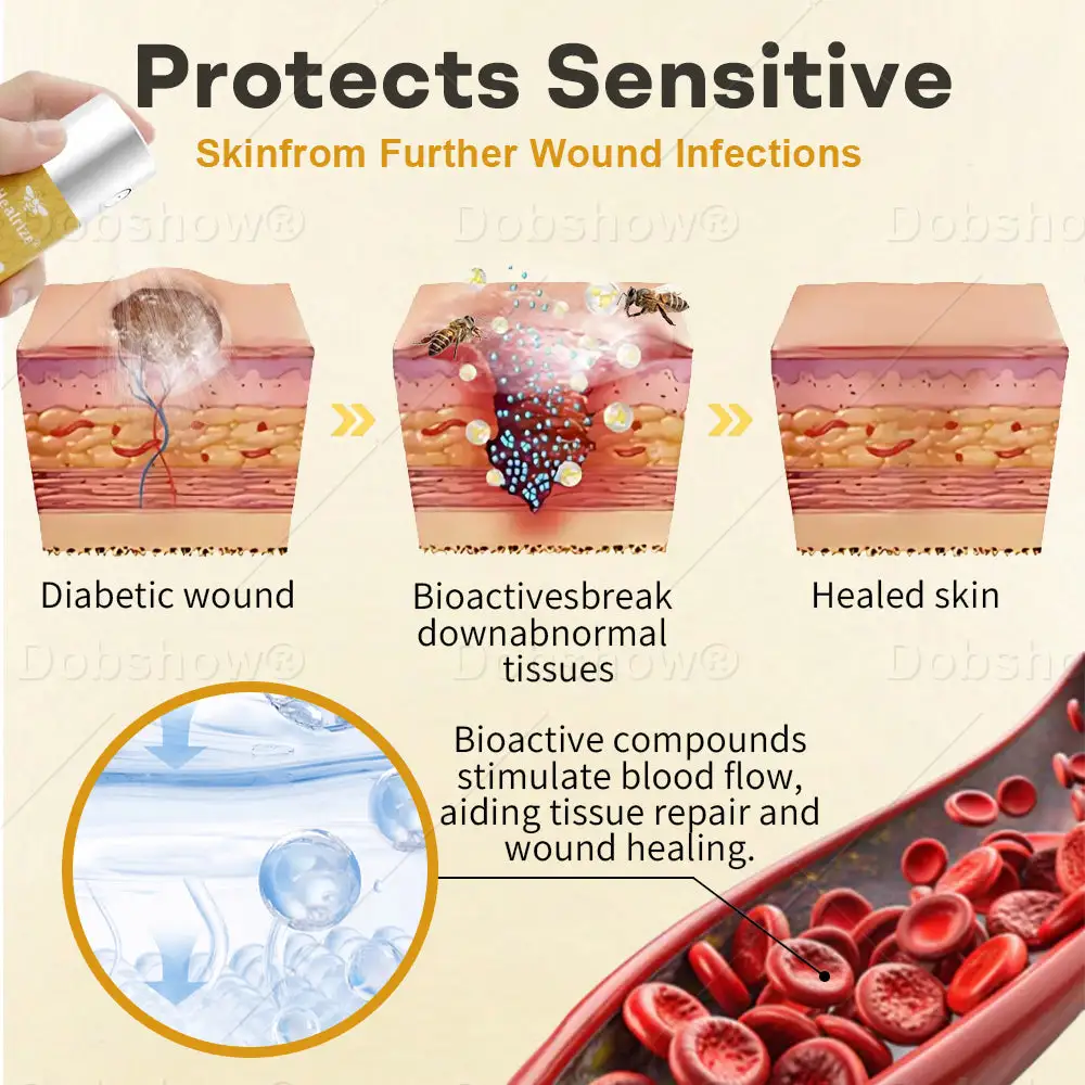 GlucoShield bišu indes brūču aerosols - Image 3