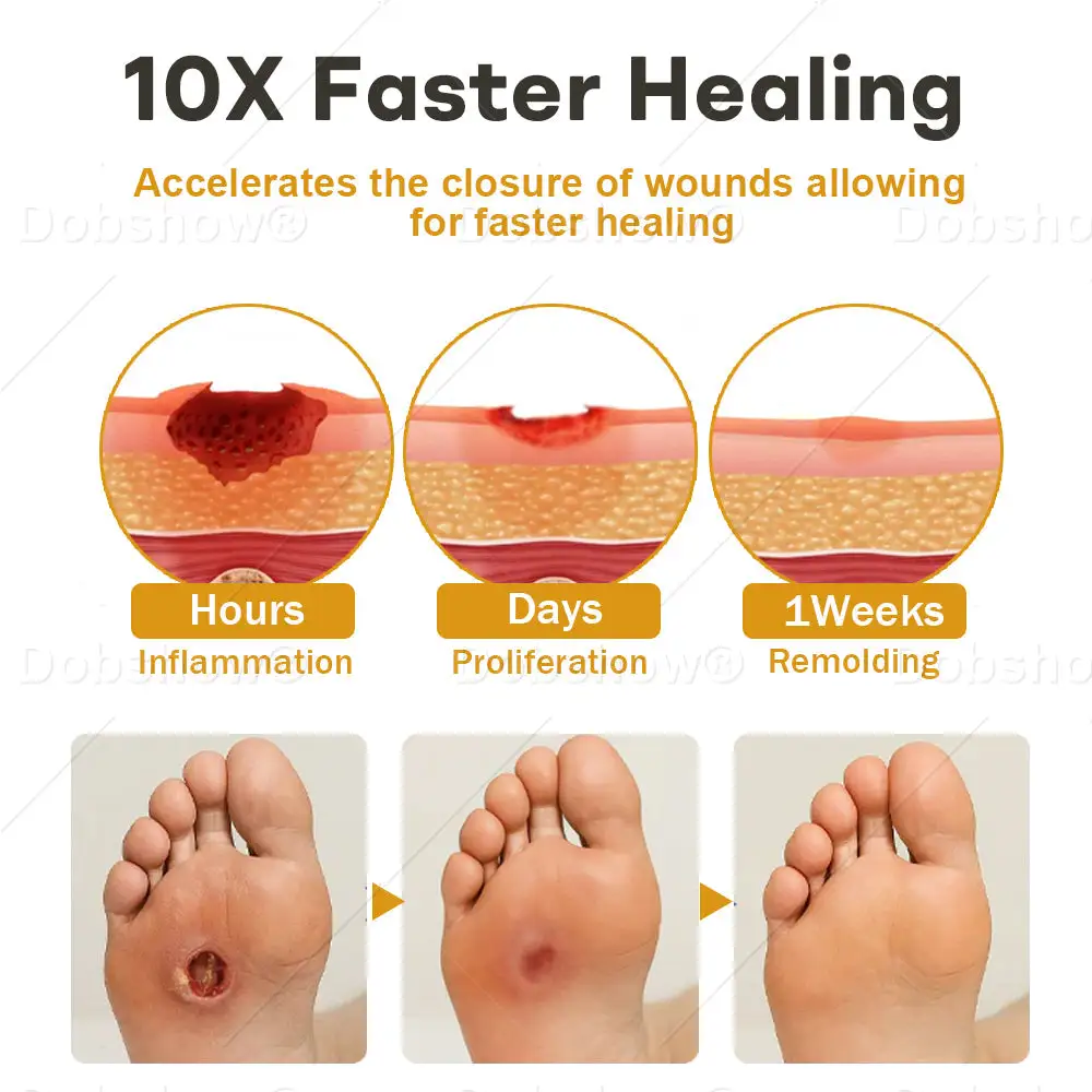 GlucoShield bišu indes brūču aerosols - Image 4