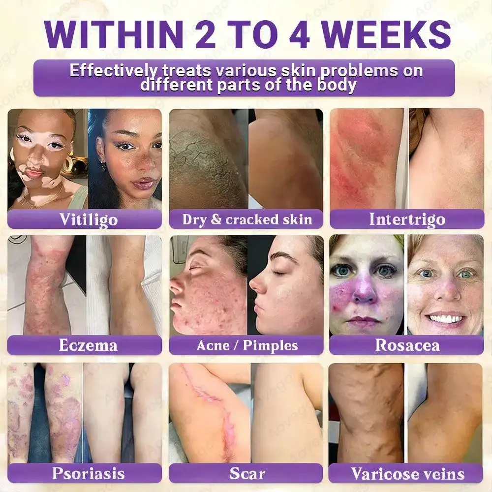 BIOTIN 10-IN-1 Advanced Skin Repair Cream - Image 2