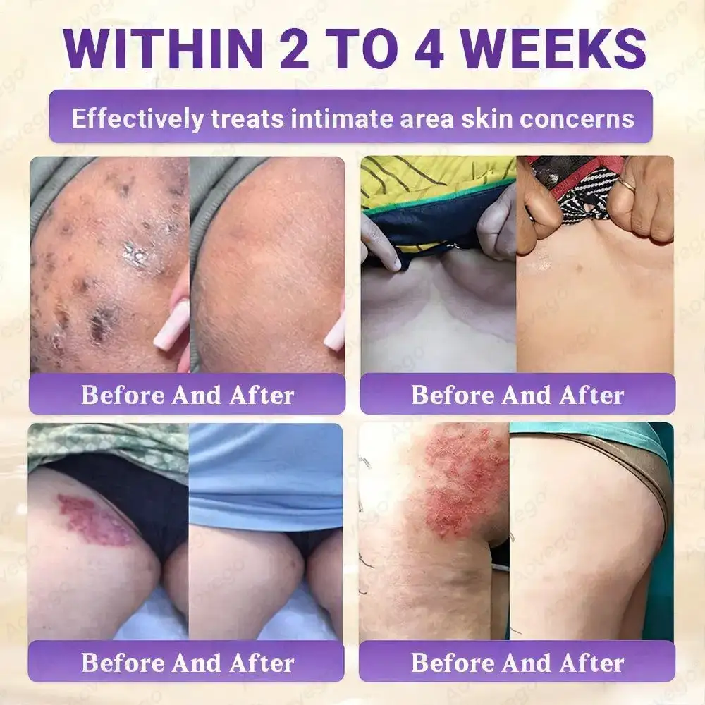 BIOTIN 10-IN-1 Advanced Skin Repair Cream - Image 3