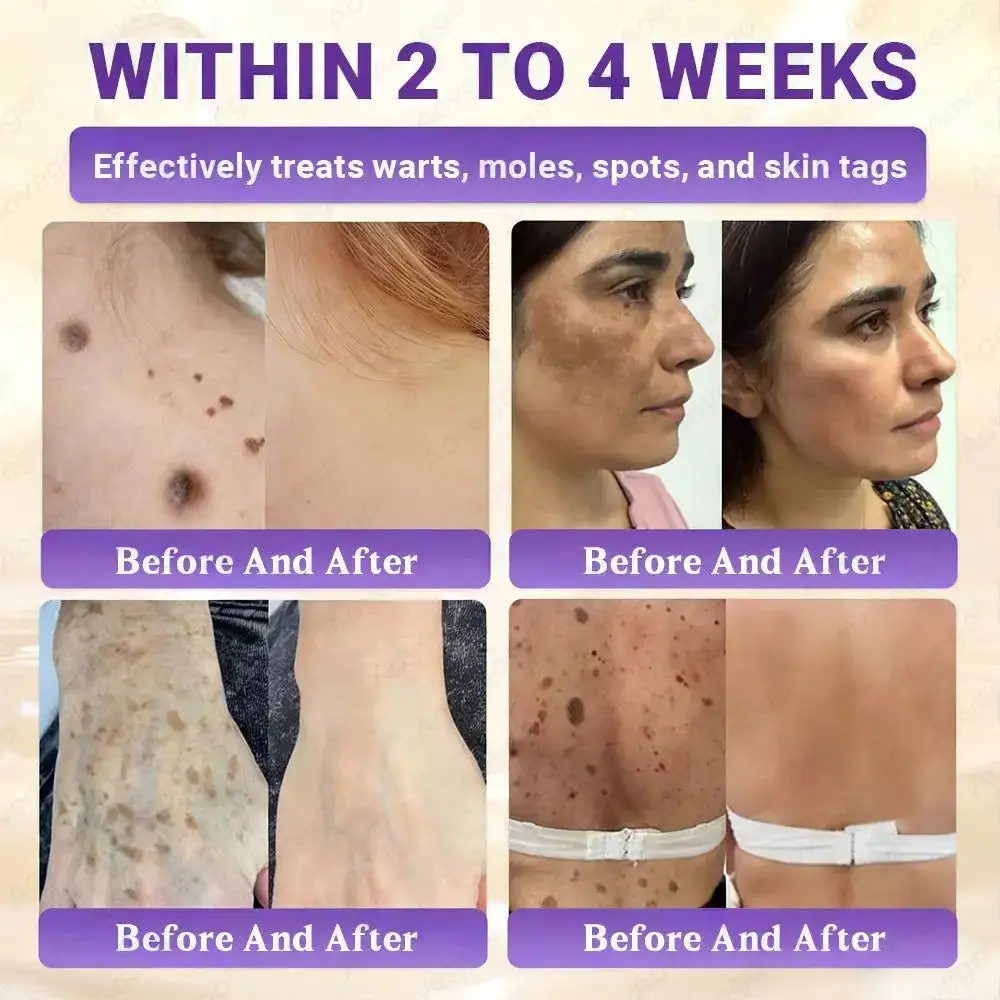 BIOTIN 10-IN-1 Advanced Skin Repair Cream - Image 4