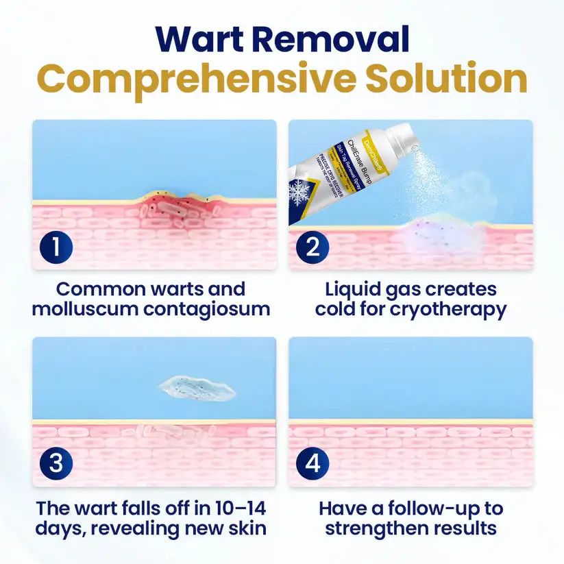 ChillErase Bump & Skin Tag Renewal Spray - Image 4