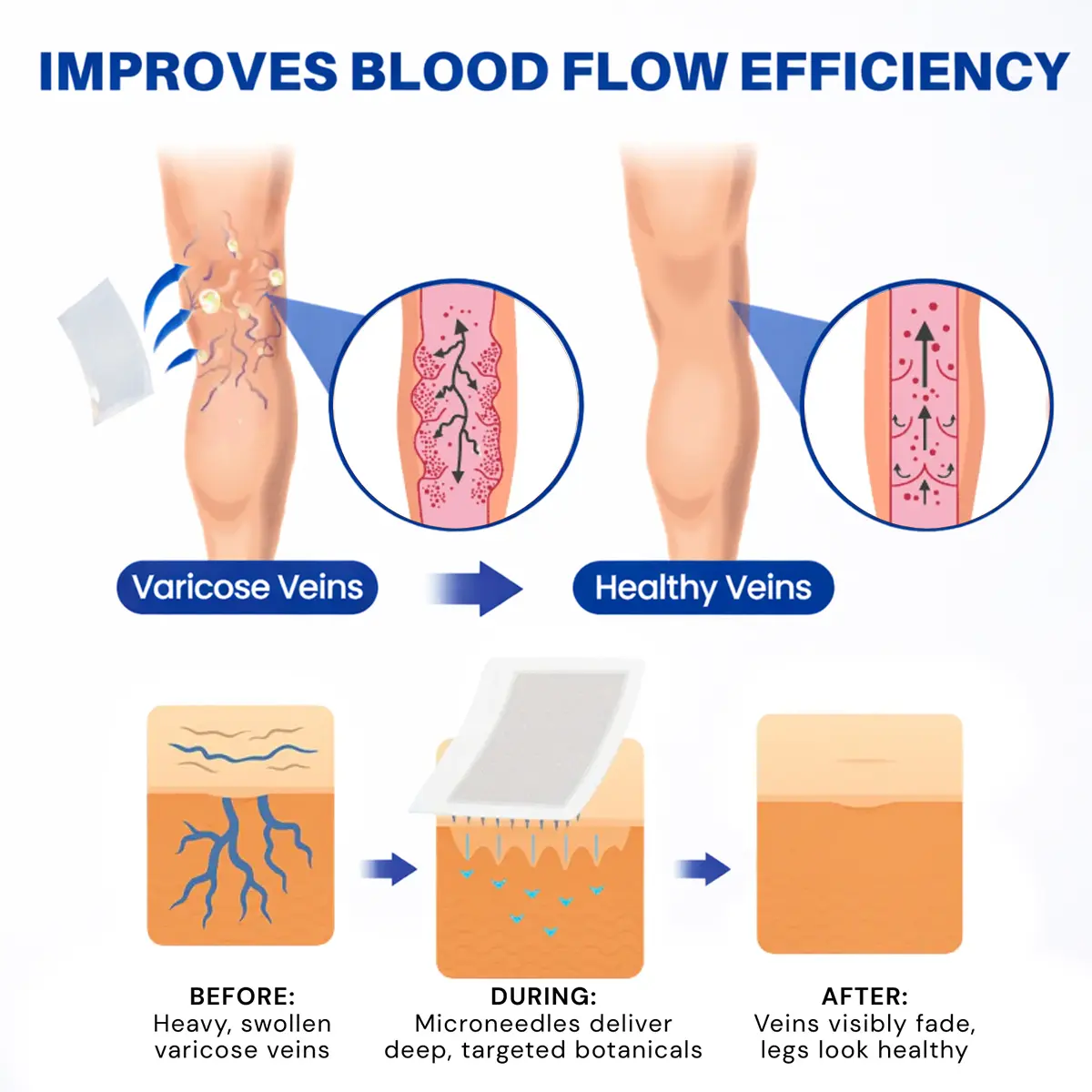 𝑽𝗲𝗶𝙣 𝘾𝐨𝐧𝘁𝗼𝙪𝙧 𝙈𝙞𝐜𝐫𝒐𝒏𝒆𝗲𝗱𝗹𝙚 - Image 2