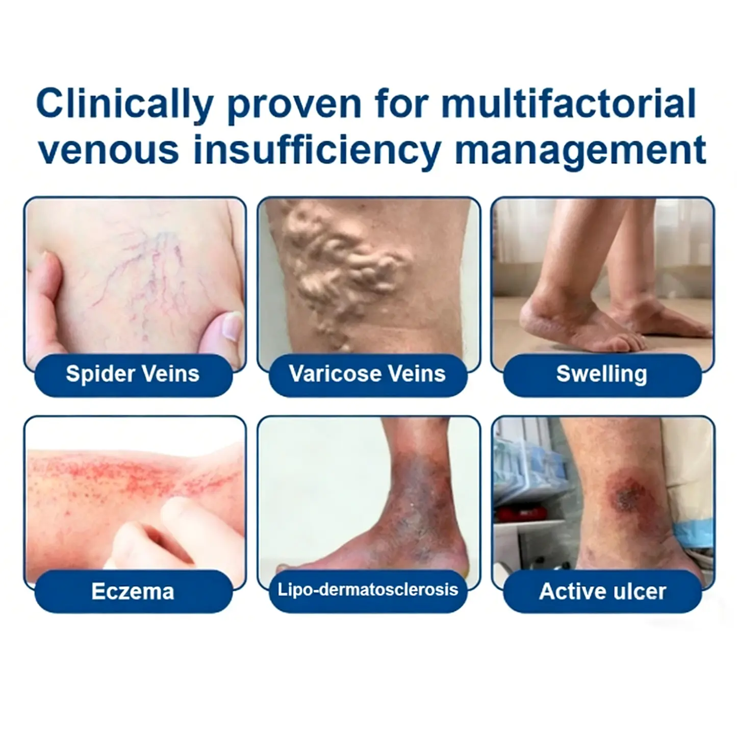 𝑽𝗲𝗶𝙣 𝘾𝐨𝐧𝘁𝗼𝙪𝙧 𝙈𝙞𝐜𝐫𝒐𝒏𝒆𝗲𝗱𝗹𝙚 - Image 3