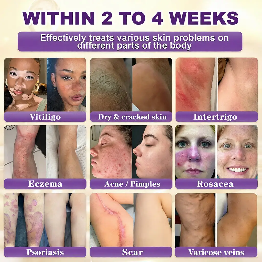 Biotīna 10-in-1 ādas atjaunošanas krēms - Image 2